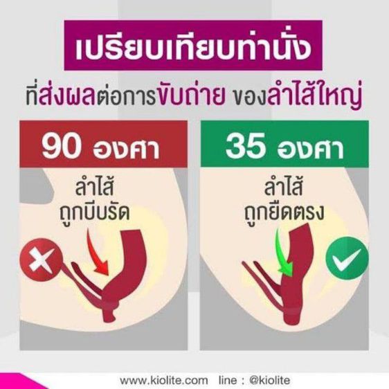 เก้าอี้นั่งห้องน้ำ รูปที่ 7