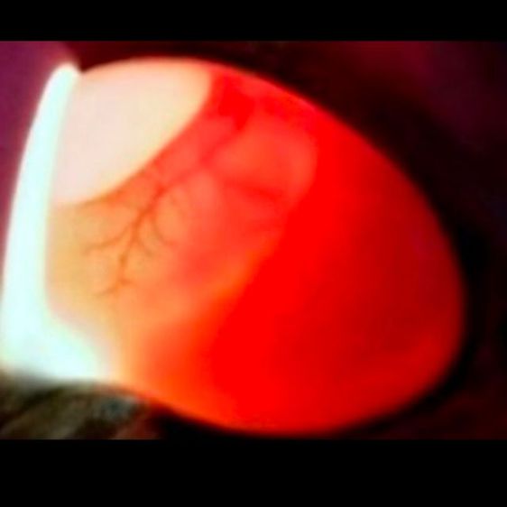 ขายไข่นกมีเชื่อทุกฟองครับ รูปที่ 3