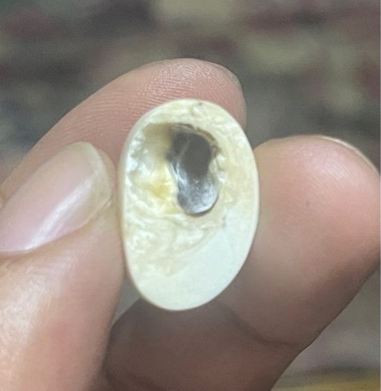 หัวแหวนหายาก รูปที่ 5