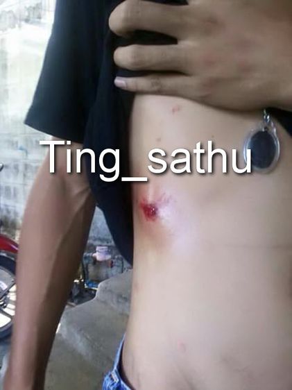 ประสบการณ์ หลวงพ่อเปิ่น วัดบางพระ เหรียญรูปไข่เนื้อทองแดง พ.ศ. 2534 ตอกโค้ต รูปที่ 18