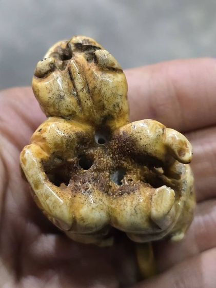 กุมารดูดรก รูปที่ 5