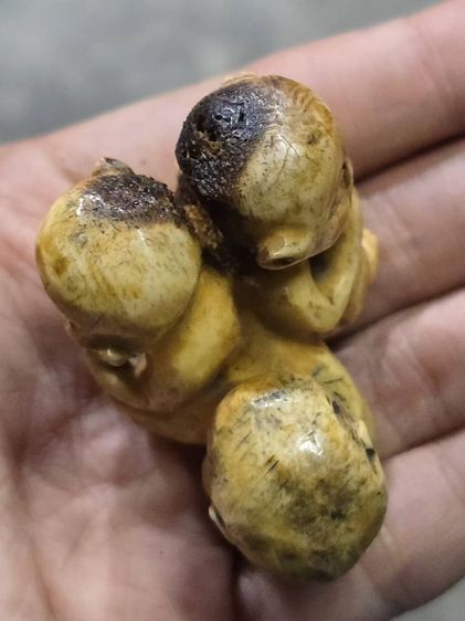 กุมารดูดรก รูปที่ 4