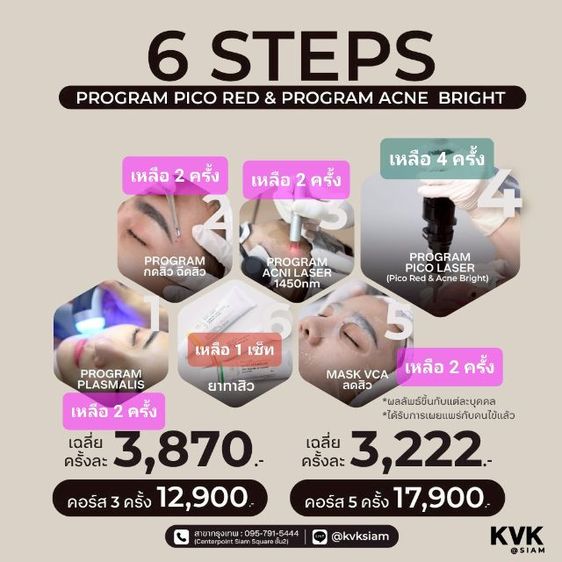 ส่งต่อคอร์สรักษาสิว Acni Clear จาก KVK Clinic สาขาสยาม