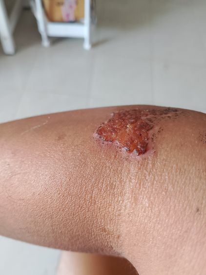 บางขุนพรหม กรุเก่า รูปที่ 3