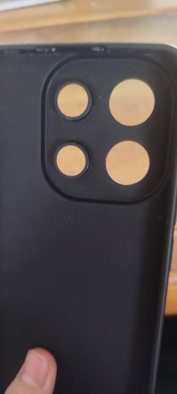 เคสมือ รูปที่ 5