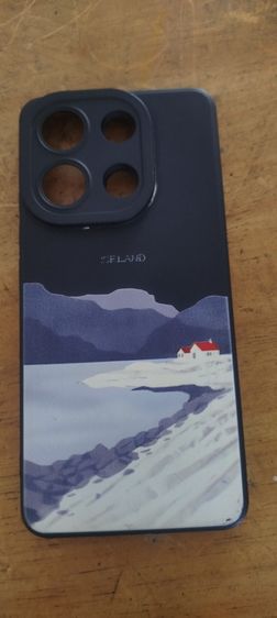 เคสมือ รูปที่ 2