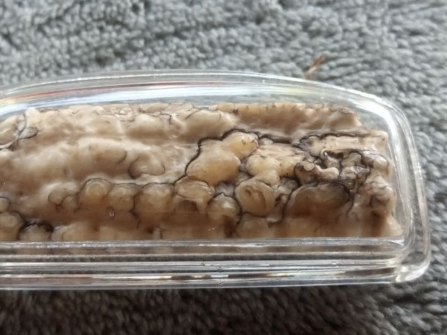 คต งอก รูปที่ 6