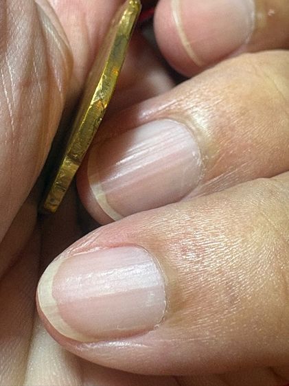 เหรียญหลวงพ่อแดง วัดเขาบันไดอิฐ รูปที่ 8