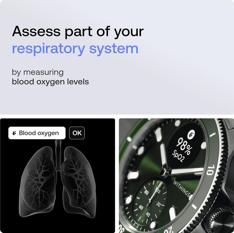 Withings ScanWatch Nova นาฬิกาหรู แพทย์ส่วนตัวบนข้อมือ แบต 30วัน 316L Sapphire ECG 33.9k รูปที่ 7