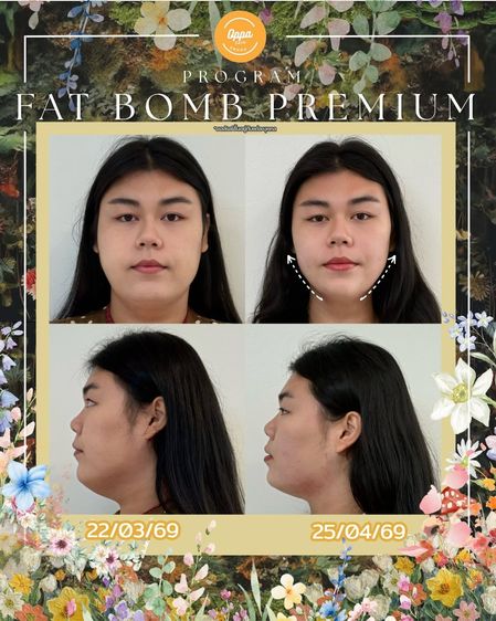 Oppa Skin Clinic คลินิกดูแลผิวและความงาม ย่านอารีย์ ใกล้ BTS อารีย์ รูปที่ 13