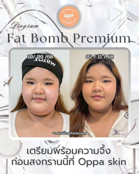 Oppa Skin Clinic คลินิกดูแลผิวและความงาม ย่านอารีย์ ใกล้ BTS อารีย์ รูปที่ 3