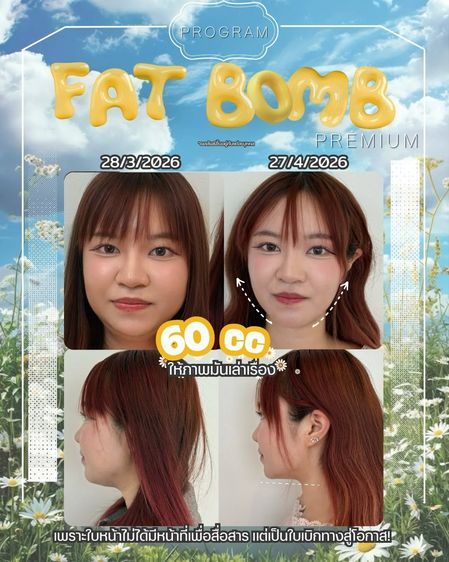Oppa Skin Clinic คลินิกดูแลผิวและความงาม ย่านอารีย์ ใกล้ BTS อารีย์ รูปที่ 12