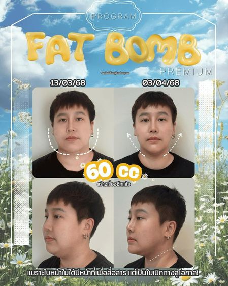 Oppa Skin Clinic คลินิกดูแลผิวและความงาม ย่านอารีย์ ใกล้ BTS อารีย์ รูปที่ 8