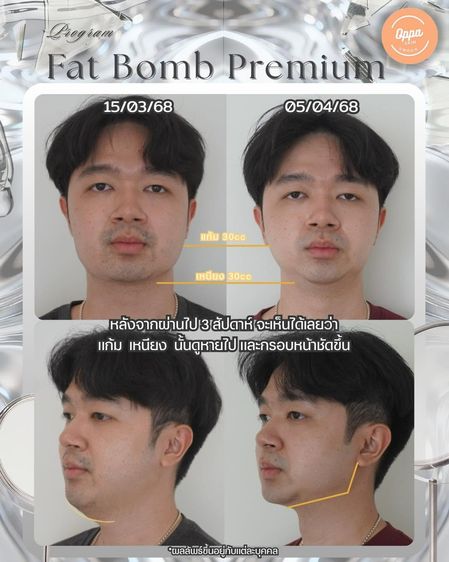 Oppa Skin Clinic คลินิกดูแลผิวและความงาม ย่านอารีย์ ใกล้ BTS อารีย์ รูปที่ 4