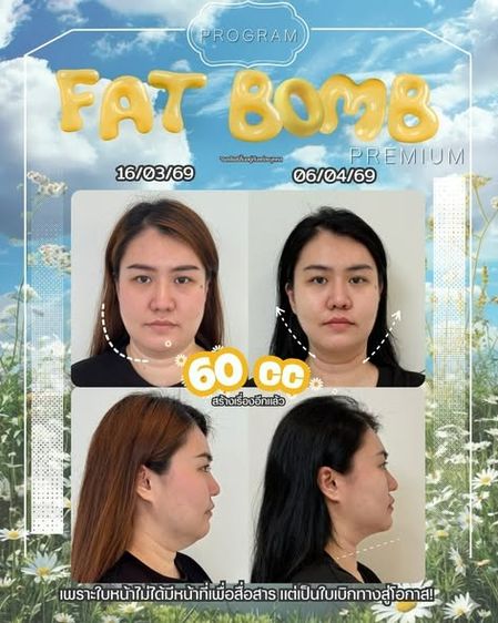Oppa Skin Clinic คลินิกดูแลผิวและความงาม ย่านอารีย์ ใกล้ BTS อารีย์ รูปที่ 9
